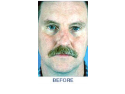 Before Image 1